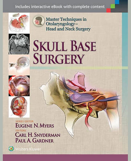 Master Techniques in Otolaryngology - Head and Neck Surgery: Skull Base Surgery