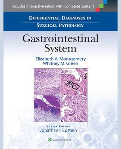 Differential Diagnoses in Surgical Pathology: Gastrointestinal System