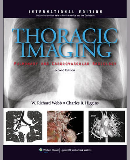 Thoracic Imaging: Pulmonary and Cardiovascular Radiology