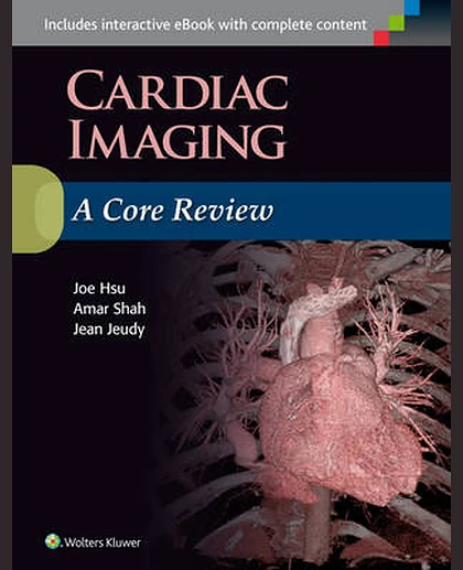 Cardiac Imaging: A Core Review