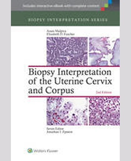Biopsy Interpretation of the Uterine Cervix and Corpus