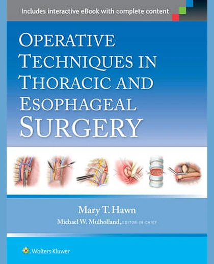 Operative Techniques in Thoracic and Esophageal Surgery