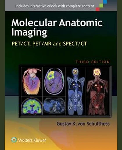 Clinical Molecular Anatomic Imaging