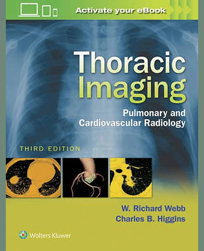 Thoracic Imaging: Pulmonary and Cardiovascular Radiology