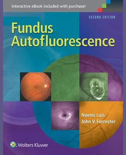 Fundus Autofluorescence