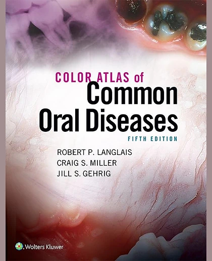 Color Atlas of Common Oral Diseases