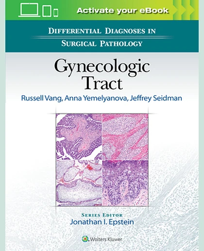 Differential Diagnoses in Surgical Pathology: Gynecologic Tract