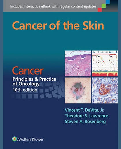 Cancer of the Skin