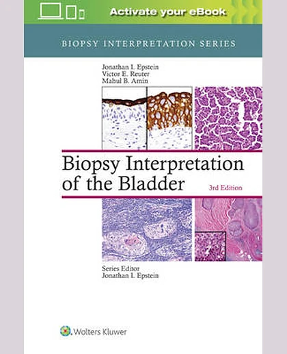 Biopsy Interpretation of the Bladder