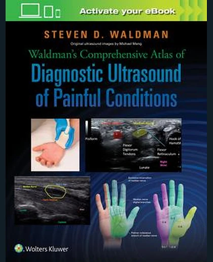Waldman's Comprehensive Atlas of Diagnostic Ultrasound of Painful Conditions