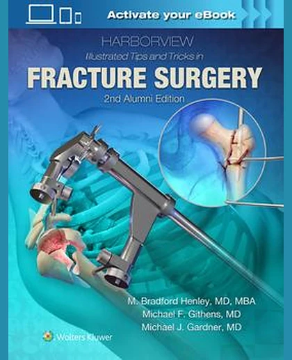 Harborview Illustrated Tips and Tricks in Fracture Surgery