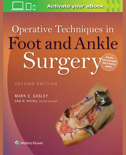Operative Techniques in Foot and Ankle Surgery