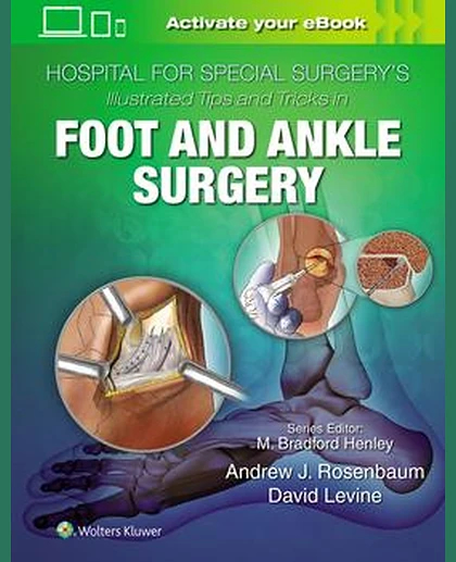 Hospital for Special Surgery's Illustrated Tips and Tricks in Foot and Ankle Surgery