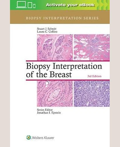 Biopsy Interpretation of the Breast