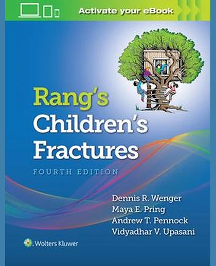 Rang's Children's Fractures