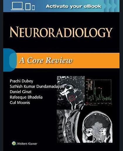 Neuroradiology: A Core Review