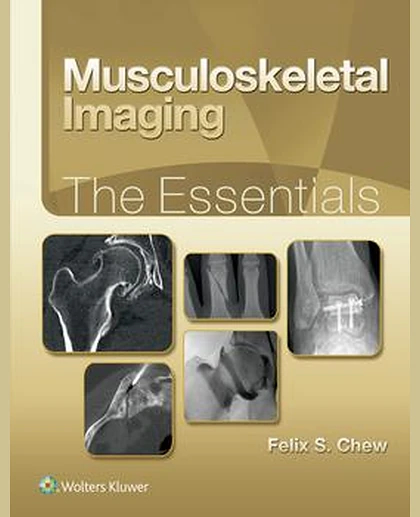 Musculoskeletal Imaging: The Essentials