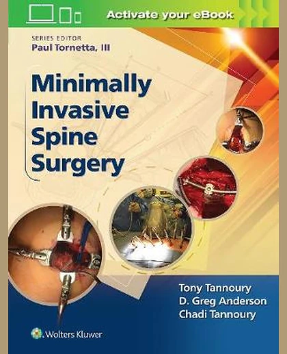 Minimally Invasive Spine Surgery