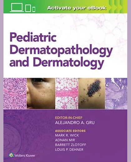 Pediatric Dermatopathology and Dermatology