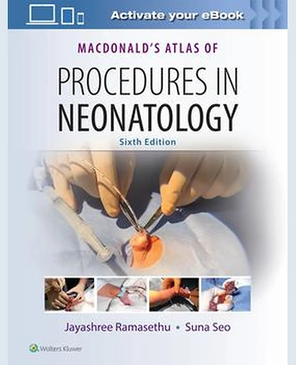 MacDonald's Atlas of Procedures in Neonatology