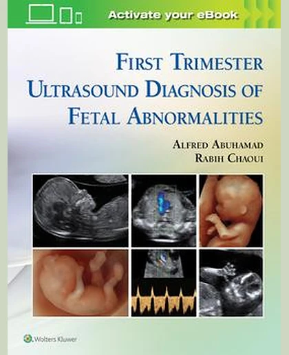 First Trimester Ultrasound Diagnosis of Fetal Abnormalities