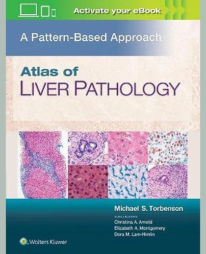 Atlas of Liver Pathology: A Pattern-based Approach