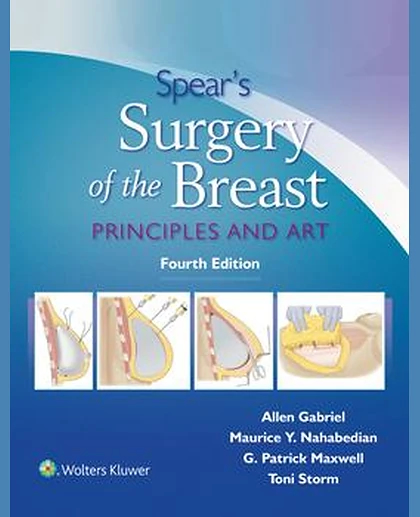 Spear's Surgery of the Breast