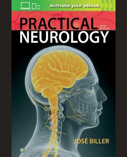Practical Neurology