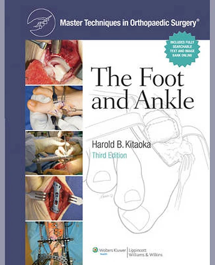 Master Techniques in Orthopaedic Surgery: Foot and Ankle