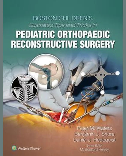 Boston Children's Illustrated Tips and Tricks in Pediatric Orthopaedic Reconstructive Surgery