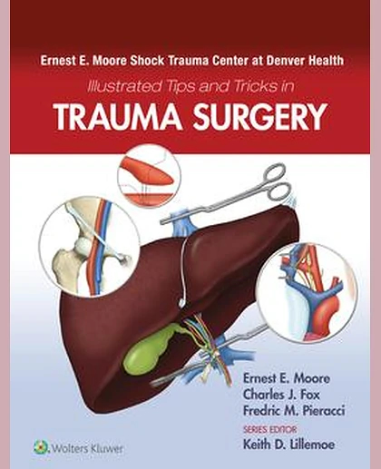 Ernest E. Moore Shock Trauma Center at Denver Health Illustrated Tips and Tricks in Trauma Surgery