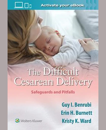 The Difficult Cesarean Delivery: Safeguards and Pitfalls