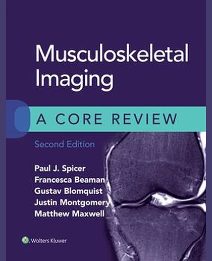 Musculoskeletal Imaging: A Core Review