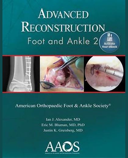 Advanced Reconstruction: Foot and Ankle 2