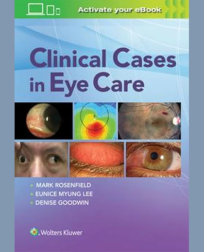 Clinical Cases in Eye Care