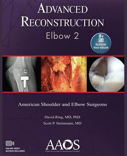 Advanced Reconstruction: Elbow 2