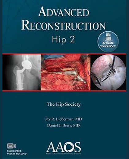 Advanced Reconstruction: Hip 2