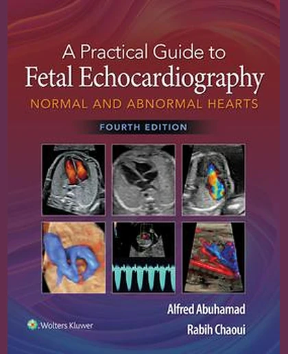 A Practical Guide to Fetal Echocardiography