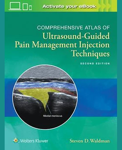 Comprehensive Atlas of Ultrasound-Guided Pain Management Injection Techniques