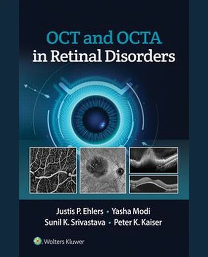 OCT and OCTA in Retinal Disorders