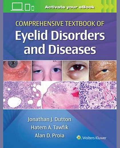 Comprehensive Textbook of Eyelid Disorders and Diseases