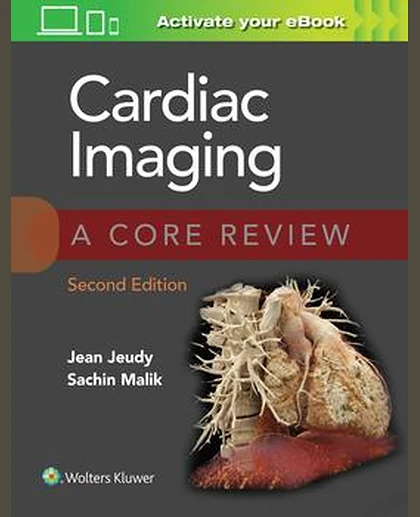 Cardiac Imaging: A Core Review
