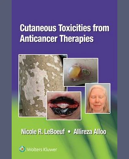 Cutaneous Toxicities from Anticancer Therapies