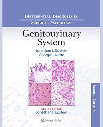 Differential Diagnoses in Surgical Pathology: Genitourinary System