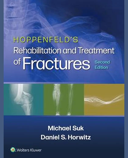 Hoppenfeld's Treatment and Rehabilitation of Fractures