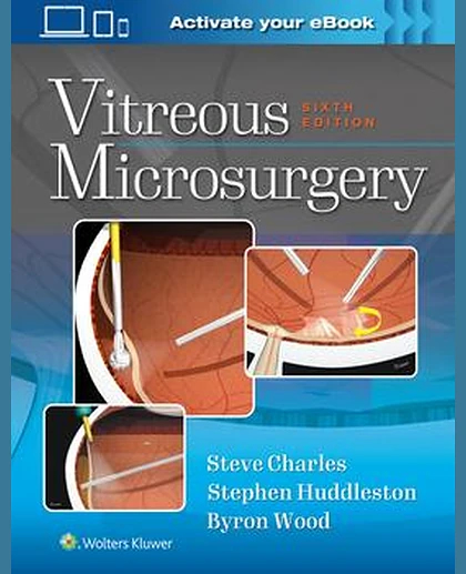 Vitreous Microsurgery