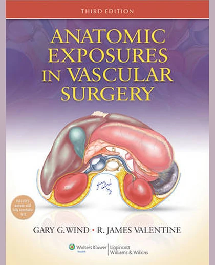Anatomic Exposures in Vascular Surgery