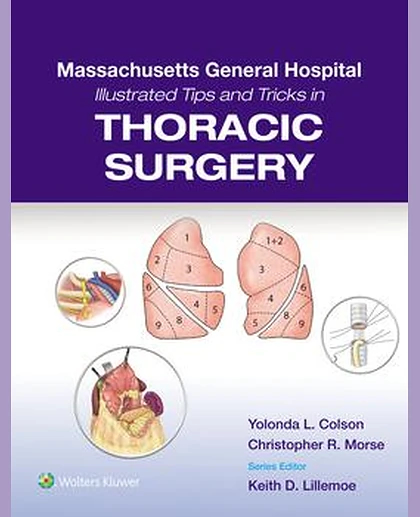 Massachusetts General Hospital Illustrated Tips and Tricks in Thoracic Surgery