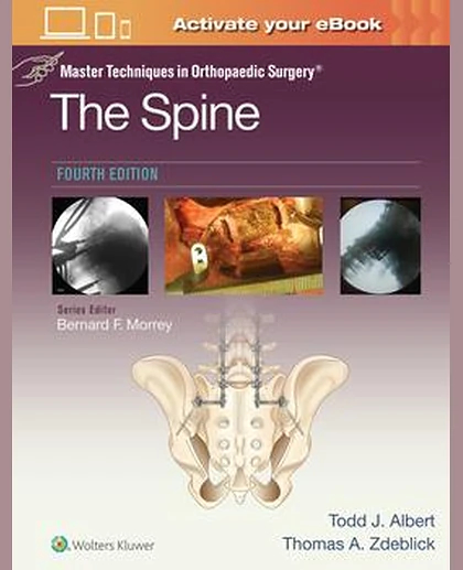 Master Techniques in Orthopaedic Surgery: The Spine