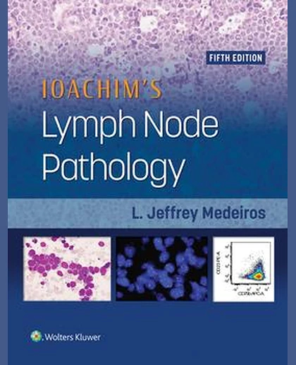 Ioachim's Lymph Node Pathology